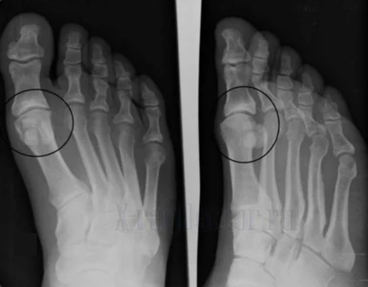 Az ízületi diagnosztizálás
