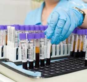 vérvizsgálat az ízületi fájdalom diagnosztizálására