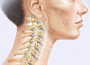 mik a nyaki osteochondrosis tünetei